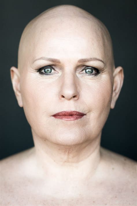 Women With Alopecia Captured In Beautiful Pictures Challenging Gender Stereotypes Art Sheep