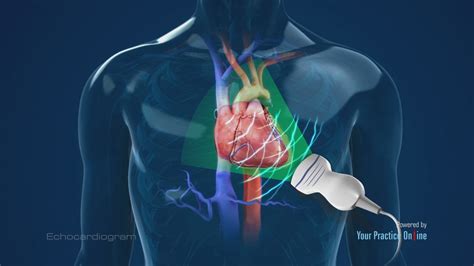 Echocardiogram Definition Uses Procedure And Side Effects Irving