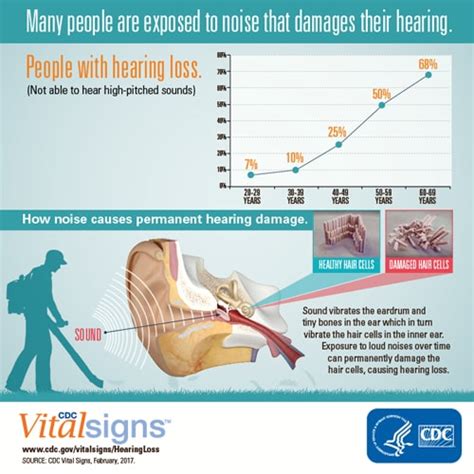 New Vital Signs Study Finds Noise Related Hearing Loss Not Limited To
