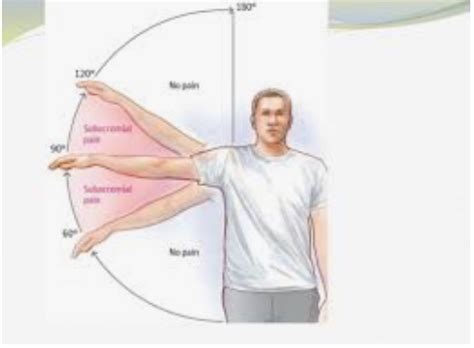 Shoulder Rehab Exercises Post Op 4 Ways To Recovery West Coast