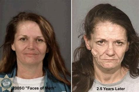 The Devastating Before And After Photos Of Crystal Meth Addiction
