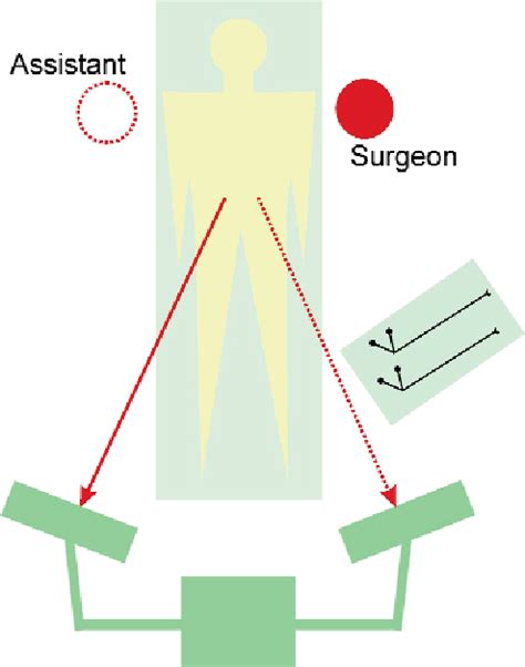 Figure 1 From Laparoscopic Transabdominal Pre Peritoneal Tapp
