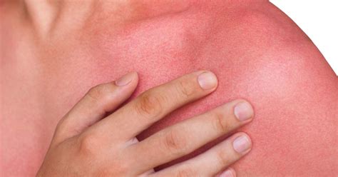 Skin Redness Causes And When To See A Doctor