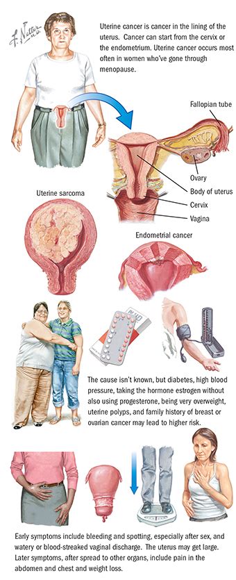 Uterine Cancer Symptoms Ponirevo