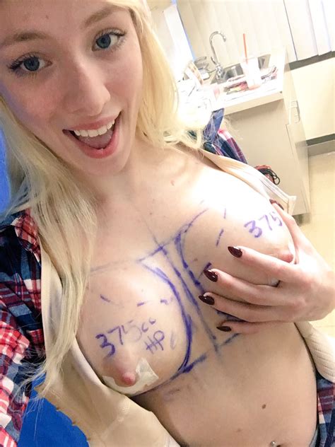 Pornstars With Fake Tits Before After Breast Augmentation