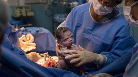 Photo Shows Baby Girl Glaring At Doctors In Epic Stare Down Moments