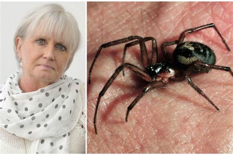 In britain, the false widow has a reputation as one of the few local spider species which is capable of inflicting a painful bite to humans, with most bites resulting in symptoms similar to a bee or wasp sting. 'False widow spider gave me black eye' - mum says bite ...