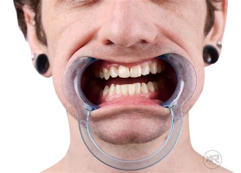 Dental Cheek Retractor Mouth Gag Naked Photo Telegraph