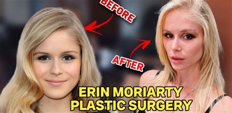 Erin Moriarty Nose Job Plastic Surgery Before And After