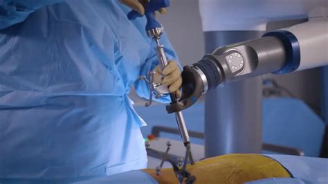 Robotic Spine Surgery Singing River Health System