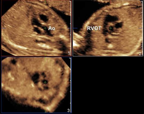 17 Best Images About Diagnostic Medical Sonography