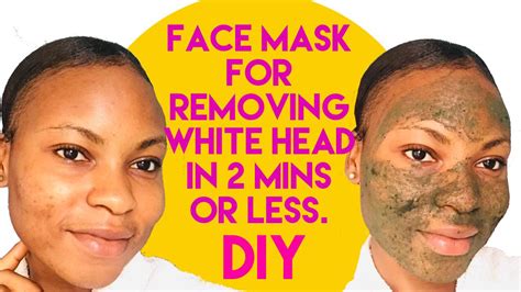 How To Get Rid Of White Head In 2 Minutes Or Less
