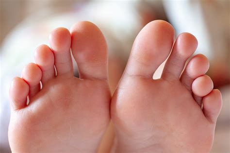 What Are The Signs Of Diabetic Feet Honestly Fit