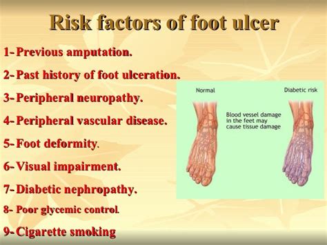 Predictors Of The Outcome Of Diabetic Foot Ulcer At Assiut University