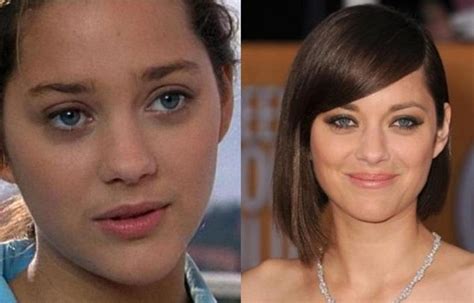 Marion Cotillard Before And After Plastic Surgery 28 Celebrity