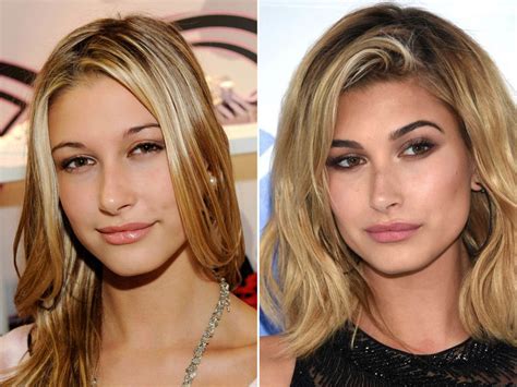 Baldwin trained as a ballet dancer, but her dancing care. Hailey Baldwin, Before and After | Celebrity plastic ...