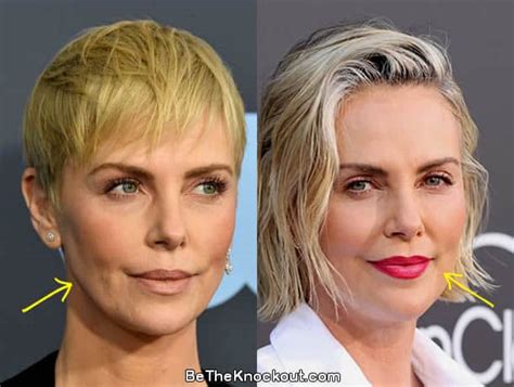 Charlize Theron Plastic Surgery Comparison Photos