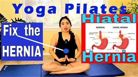Bulge On Upper Abdomen Fix Hiatal Hernia Gentle Easy Mat Yoga Pilates Workout At Home Youtube