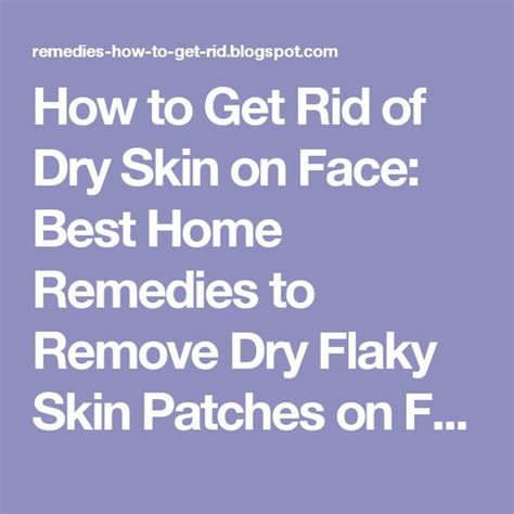 Home Dry Skin On Face And Skin Care On Pinterest