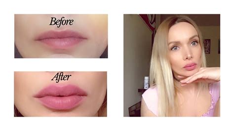 tricks and tips on how to get bigger lips without injections easy diy youtube