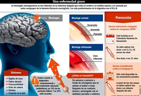 Meningitis can occur when fluid surrounding the meninges becomes infected. Dos muertes elevan alerta por la bacteria de la meningitis ...