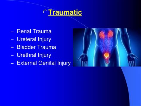 Ppt What Urological Problems Bring Patients To The Emergency
