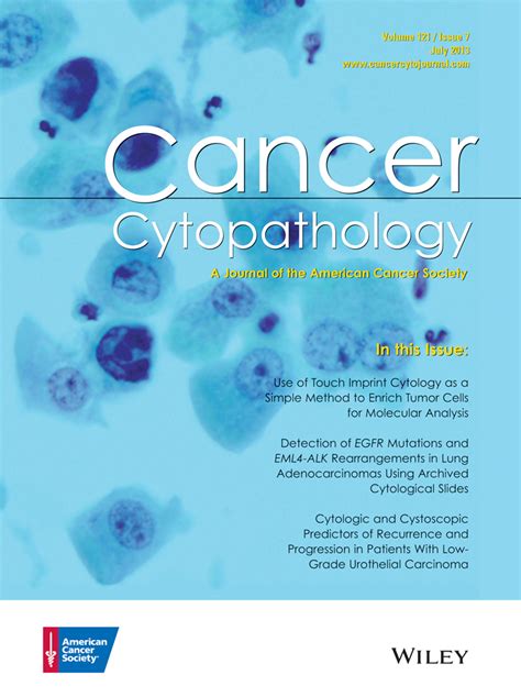 Use Of Touch Imprint Cytology As A Simple Method To Enrich Tumor Cells For Molecular Analysis