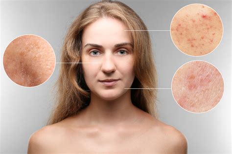 4 Most Common Skin Problems Kessel Dermatology