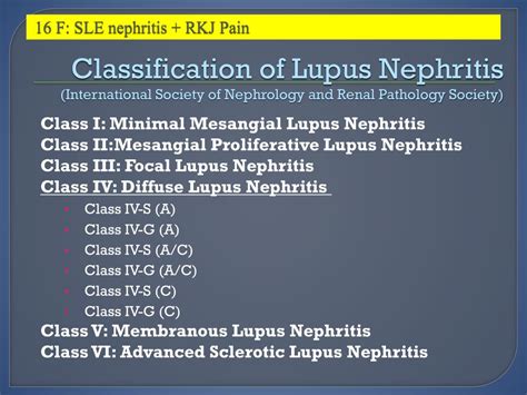Ppt Systemic Lupus Erythematosus Right Knee Joint Pain Powerpoint
