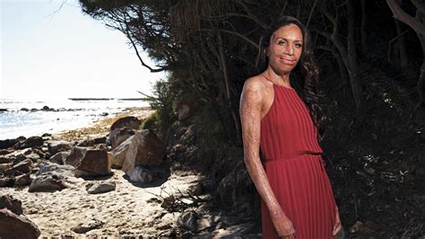 Turia Pitt Reflects On The Fire Years On Daily Telegraph