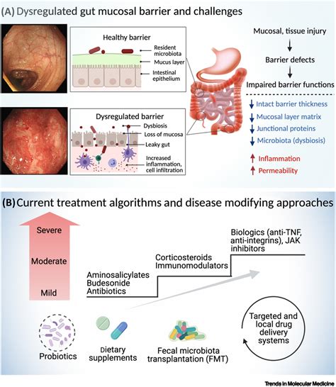 Ibd Disease Modifying Therapies Insights From Emerging Therapeutics