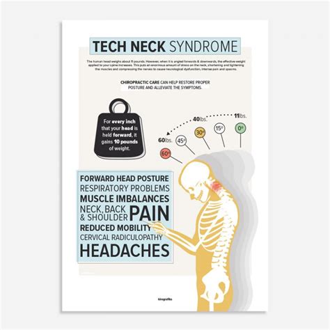 Tech Neck Syndrome Poster Text Neck Syndrome Poster
