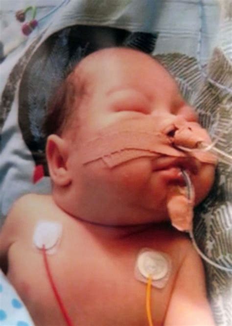 Miracle Baby Noah Who Was Born Weighing Just 2lbs 4oz Mirror Online