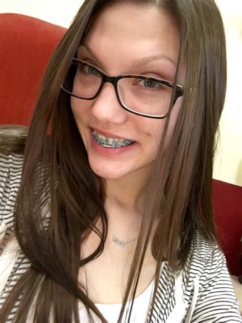 Fundraiser By Sasha Meow Help Me Pay For My Braces Please