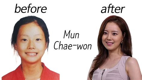 Mun Chae Won Before And After Youtube