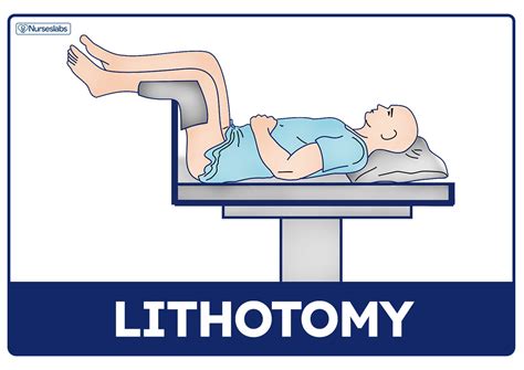 Dorsal Lithotomy Position