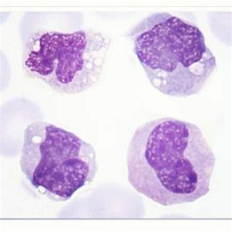 O Monocito Hemoclass Hematologia E Medicina Diagnóstica