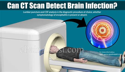 Can Ct Scan Detect Brain Infection