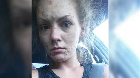 Former Meth Addict Shows Off Her Amazing