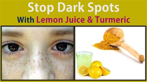 How To Use Lemon Juice For Dark Spots On Face Stop Dark Spots With