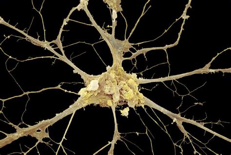 We did not find results for: Nervous Tissue: Neurons and Glial Cells