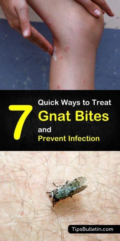 Quick Ways To Treat Gnat Bites And Prevent Infection Gnat Bites How To Get Rid Of Gnats
