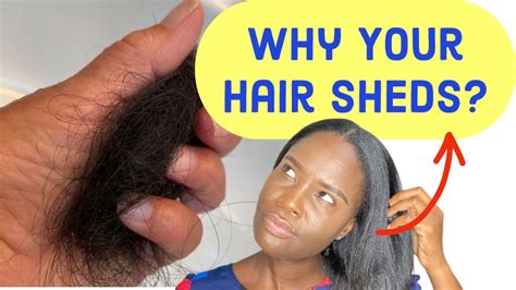 Stop Hair Hair Shedding The Real Reason Why Your Hair Is Shedding And How To Stop It Youtube