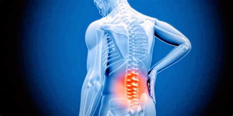 Causes Of Low Back Pain Pt Master Guide