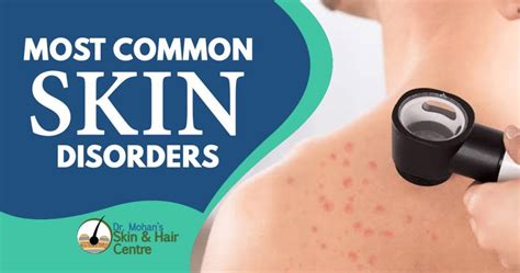 What Are The Most Common Skin Disorders