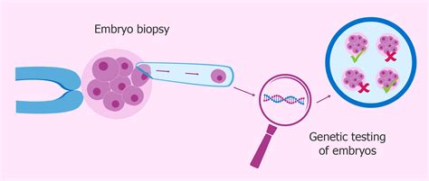 Preimplantation Genetic Screening Of Embryos Procedure Step By Step