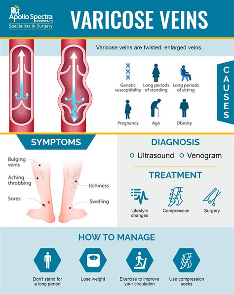 Varicose Veins Causes Treatment Diagnosis And Prevention