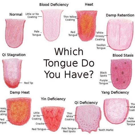 What Does Your Tongue Say About Your Health Tongue Health Tongue