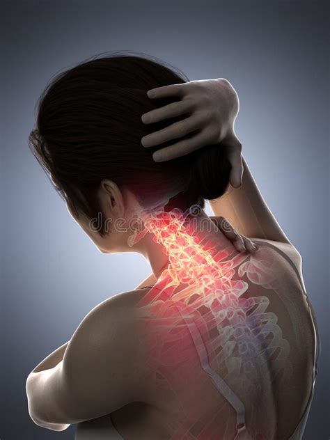 A Woman Having A Painful Neck Stock Illustration Illustration Of