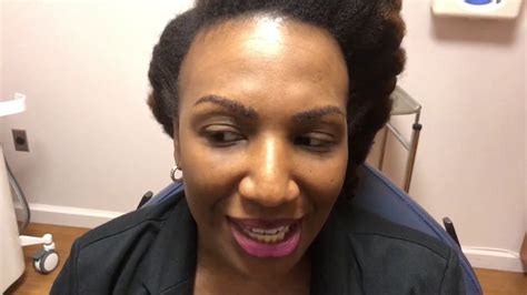Dallas African American Eyebrow Hair Transplant Youtube